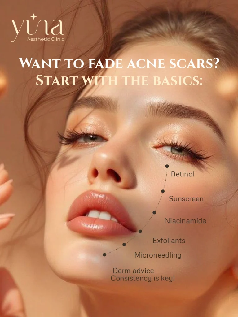 Yina Clinic Acne Scars Tips